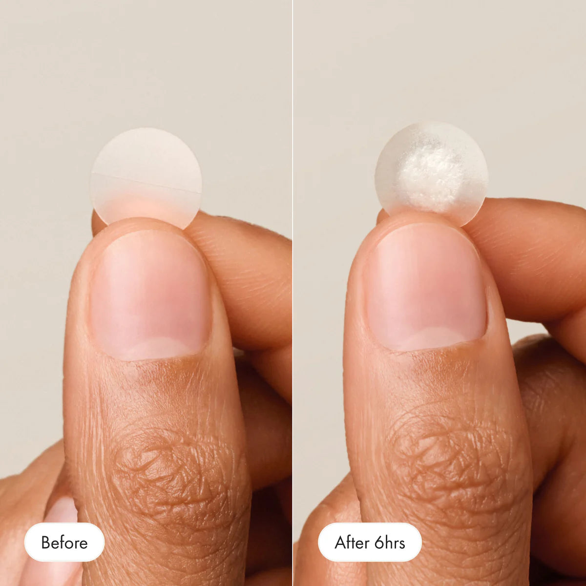 Bubblegum™ ClearSkin Dots